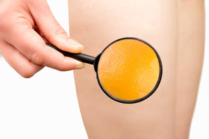 Will Collagen Help with Cellulite Appearance?